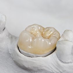 Dental crown on model smile