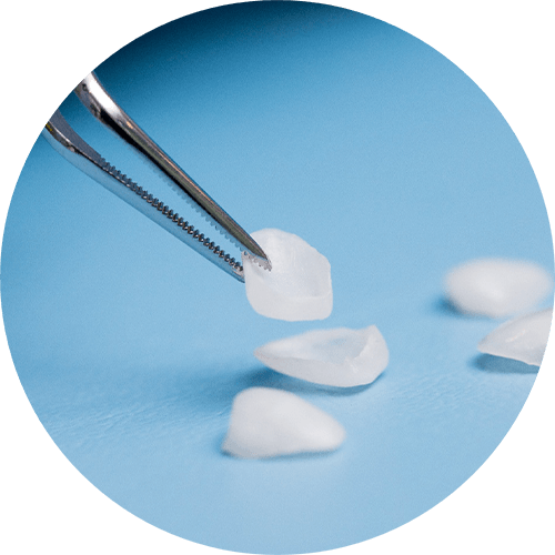 Tweezers picking up veneers on a light blue surface